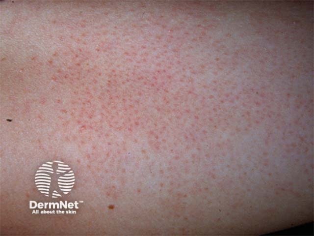 Derm Net - Dermdirect